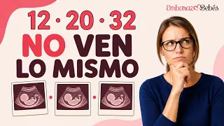 ¡OJO! ¿Cuántas ecografías se hacen? Semanas 12, 20 y 32 - MITOS y VERDADES ¿qué detectan y qué no?