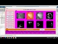 Glaucoma detection through digital processing from fundus images using MATLAB