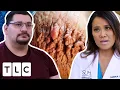 Rupturing Thigh Chafing Keeps Him From Fully Being Part Of His Family Dr Pimple Popper