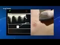 Download Lagu Venue™ Family POCUS Lung Sweep for Pediatrics