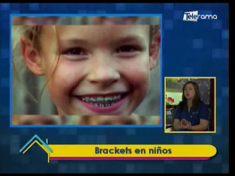 Brackets en niños 