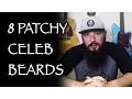 8 Patchy Celebrity Beards