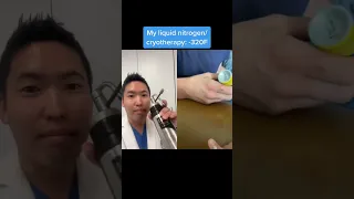 Dermatologist Reacting to Freeze-Away Wart Treatment
