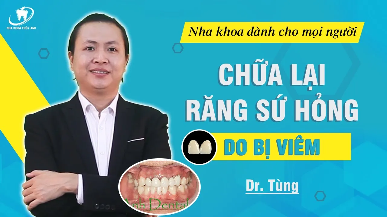 Outline Video Cách chữa lại răng sứ bị viêm, chảy máu.