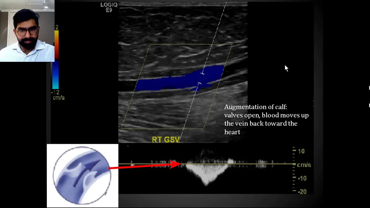 Venous Ultrasound Physiology