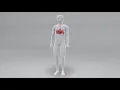 What is a Hiatal Hernia Animation & How It Causes Reflux