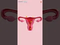 Endometriosis Symptoms and Diagnosis Dr Aneeta Talwar Manipal Hospital Whitefield