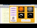Diabetic Retinopathy Classification Using CNN With Source Code Diabetic Retinopathy Using Matlab