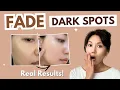 How to Fade Dark Spots on Face and Hyperpigmentation Ultimate Routine to Even Out Skin Tone