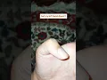 help why is my thumb shaking