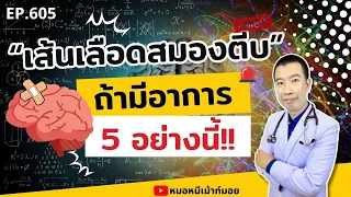 อาการอ่อนแรงครึ่งซีกหมายถึงอะไร และเป็นสัญญาณของโรคอะไร?