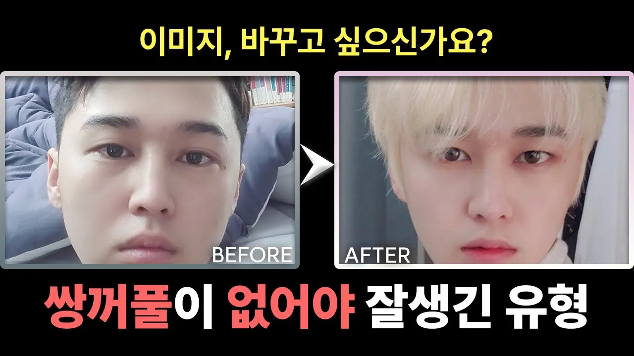 [성형리뷰] 쌍꺼풀이 안 어울리는 남자, 요즘 남자 눈의 트렌드는?