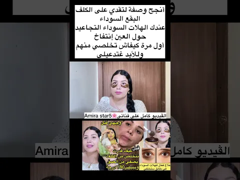 انجح وصفة للكلف والتصبغات علاج نهائي للهلات السوداء في دقائق تختفي