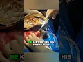 Download Lagu He Said His Belly Hurt… Surgeons Found Worms 🪱