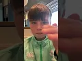 Worlds biggest forehead