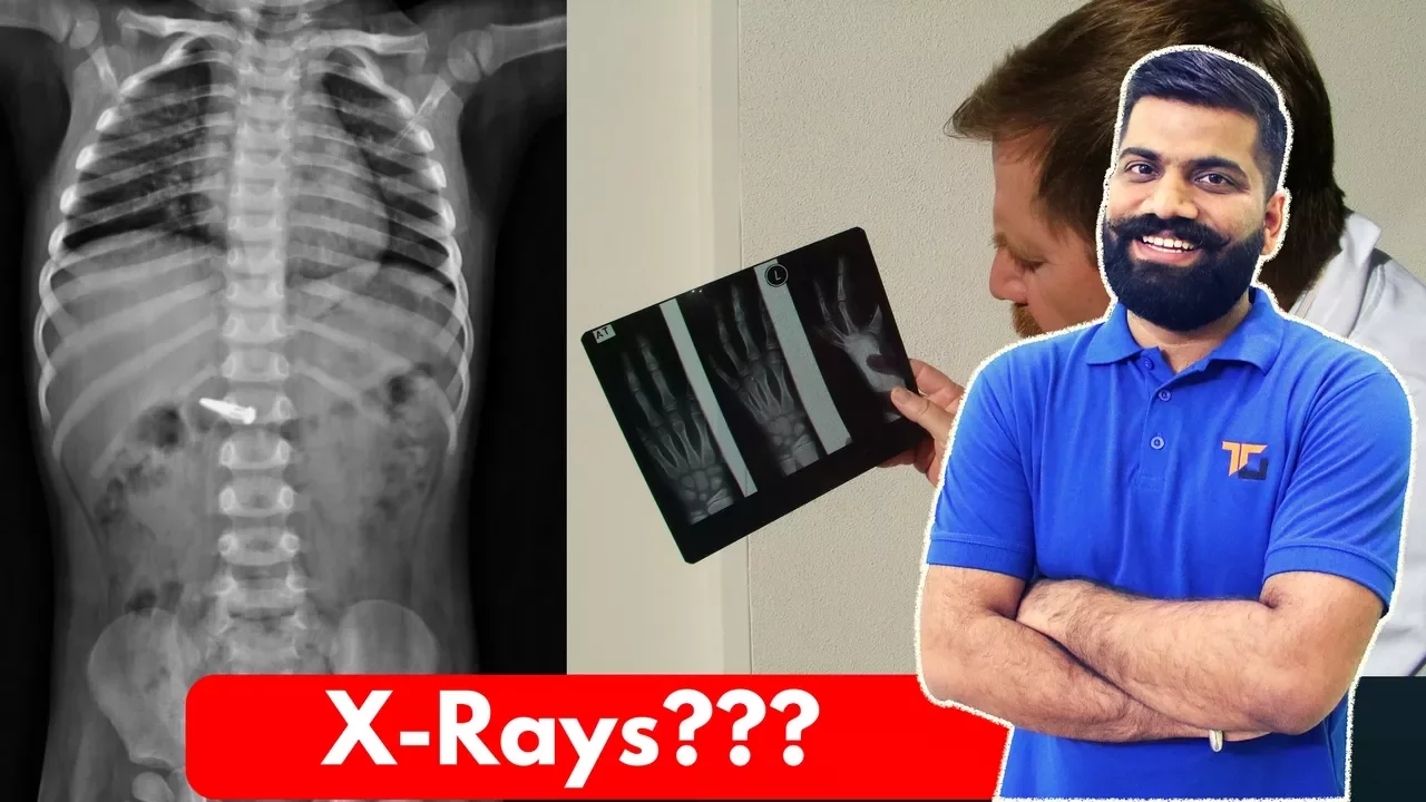 X-Rays.. The Powerful Waves? X-Rays Explained!!!