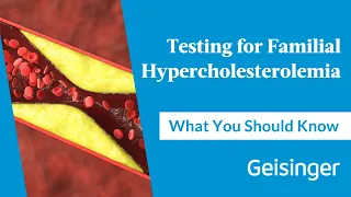 testing for familial hypercholesterolemia fh what you should know