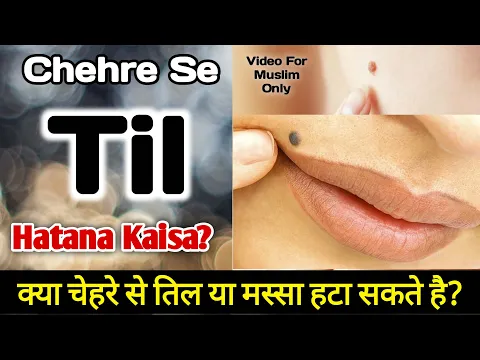 til ya massa hatana kaisa | kya til masse ka ilaj karwana jaiz hai | til ko khatam karwana