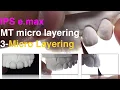 Download Lagu IPS e max MT 3  Micro layering