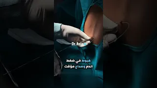 إبرة أو قسطرة الظهر التي تعطى قبل الولادة 