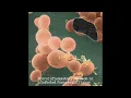 Download Lagu PORPHYROMONAS GINGIVALIS - NECROINFLAMMATORY CASCADE IN INFECTED PANCREATIC TISSUE (2025)