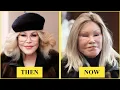 Most UNBELIEVABLE Plastic Surgery of Hollywood Celebrities I then and now 2026