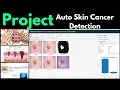 Best Skin Cancer Datasets for Machine Learning CNN Projects