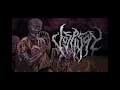 Download Lagu Vospison - Psylocybin Hypochondriasis (Official Lyric Video)
