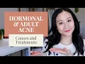 Treating Hormonal Acne Dermatologist Tips