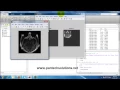 Matlab code for wavelet based Image fusion