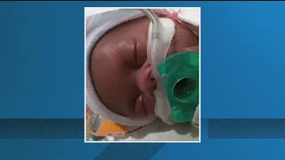 Baby Chance Update on infant whose mother carried him while brain dead