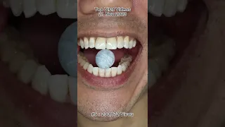 The Most Satisfying Chocolate & Candy ASMR Compilation