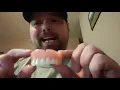 Afforable Denture vs Dentist Denture