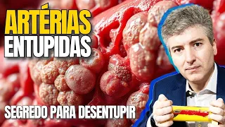Are your arteries clogged? Find out how to unclog them and avoid amputation!