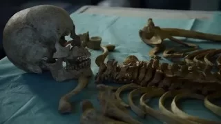 Paleopatologia, malattie dal passato