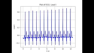 Digital Signal Processing Using Python Chapter 1 Part5