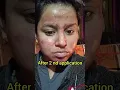 Download Lagu I TRIED THE ORDINARY PEELING SOLUTION #theordinarypeelingsolution #theordinary #shorts #ashortaday