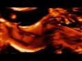 Ben Böhmer - Revelation feat PBSR - Barry Can’t Swim Remix