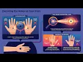 Meaning of Moles on the Left Hand True Meaning Extremely rare and Lucky sign