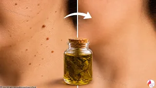 This oil heals everything! 100,000 times more powerful! ☘️A true treasure from nature!