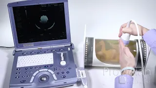 4d ultrasound tutorial understanding 4d imaging