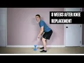 Exercises 8 Weeks After Surgery - Total Knee Replacement