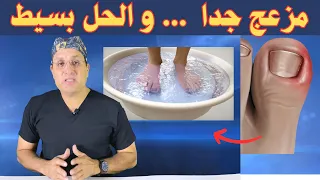 أخيرا   الحل الأفضل لمشكلة الظفر الغائر المزعج  دندنها