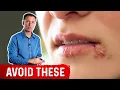 Avoid These Foods If You Have Herpes