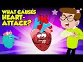Download Lagu What Causes Heart Attack? | How to Keep Your Heart Healthy? | Heart Attack Signs and Symptoms