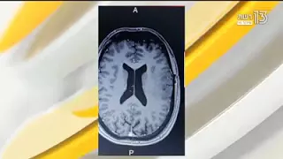 יהודה הבר שמן הקנאביס העלים את הגידול 