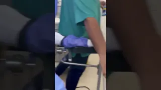 عملية دوالي الساق بقسطرة الليزر وبدون فتح جراحي 