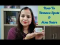 How To Remove Spots Acne Scar COSRX Centella Blemish Cream Review Outlive Like Priyanka