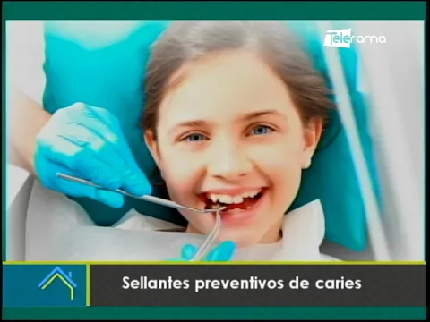 Sellantes preventivos de caries