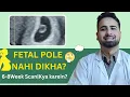FETAL pole Not seen at 6 8 WEEKS Doctor s Honest Advice Kya KAREIN